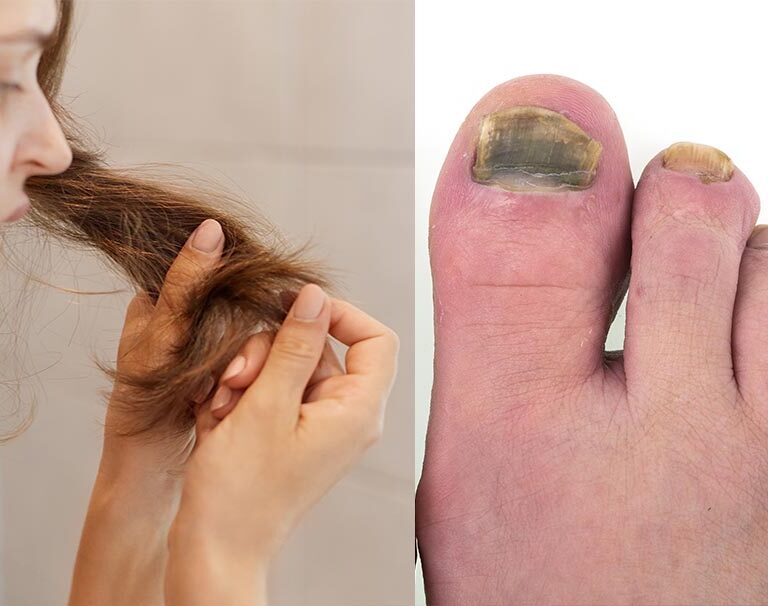Skin Conditions/Infections - Wanneroo Podiatry